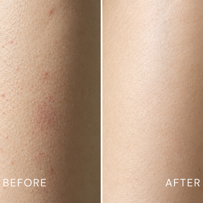 Ynari Glycolic Acid Exfoliating Body Stick