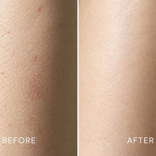 Ynari Glycolic Acid Exfoliating Body Stick